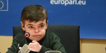 Andalucía dará cobertura pública al tratamiento de la ‘piel de mariposa’ y abre una nueva vía para pacientes con epidermólisis bullosa