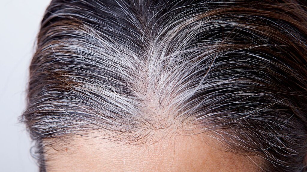 Aplicar bicarbonato de sodio y romero en las canas: por qué este remedio viral merece más cautela que entusiasmo